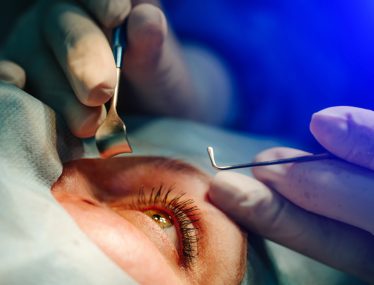 patient having cataract surgery